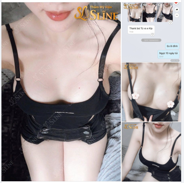Lời cảm ơn ngọt ngào của khách hàng dành cho bác sỹ ekip Thẩm Mỹ Viện Sline.