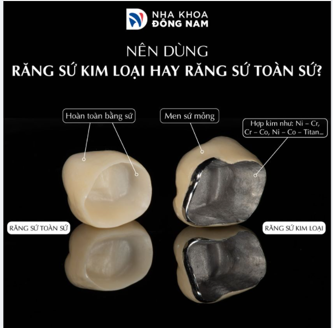 Lựa chọn loại răng sứ phù hợp còn tùy thuộc vào nhu cầu và điều kiện kinh tế của mỗi bệnh nhân.