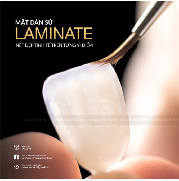 MẶT DÁN SỨ LAMINATE - NÉT ĐẸP TINH TẾ TRÊN TỪNG VI ĐIỂM