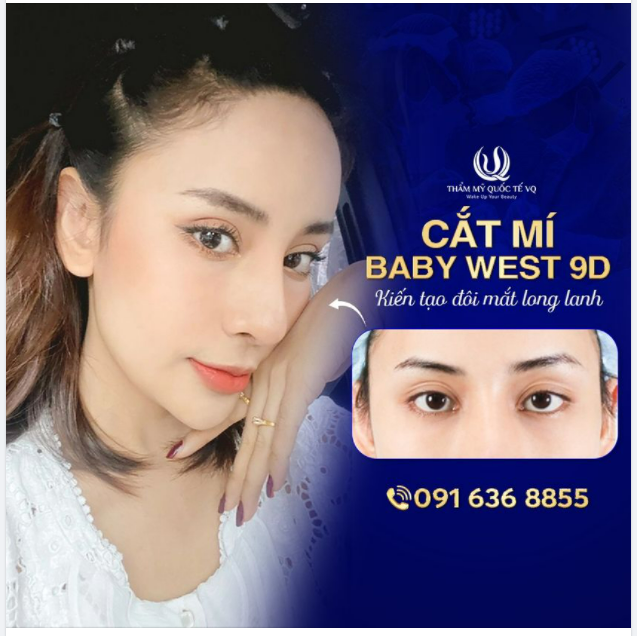 Mắt hai mí, đẹp mê ly Xinh kiêu kì, long lanh hết ý