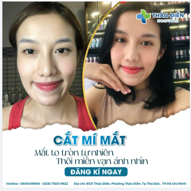 MẮT TO TRÒN TỰ NHIÊN - THÔI MIÊN VẠN ÁNH NHÌN