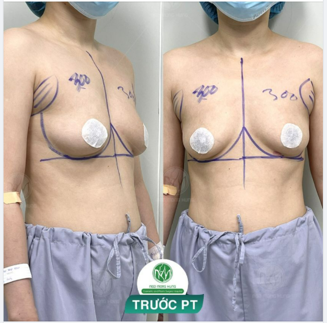 MẸ BỈM 2 CON VỚI QUYẾT ĐỊNH TÂN TRANG VÒNG 1