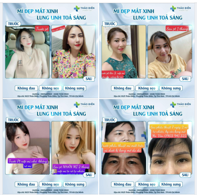 MÍ ĐẸP - MẮT XINH, LUNG LINH TOẢ SÁNG