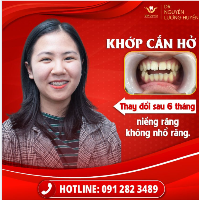 "MÌNH ĐÃ NHIỀU LẦN MẮC CÁC BỆNH VỀ ĐƯỜNG HÔ HẤP DO KHỚP CẮN HỞ"