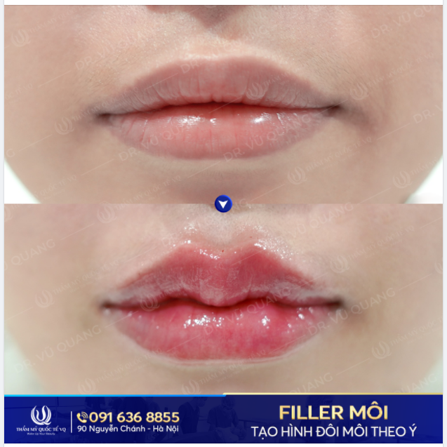 Môi căng mọng sức sống