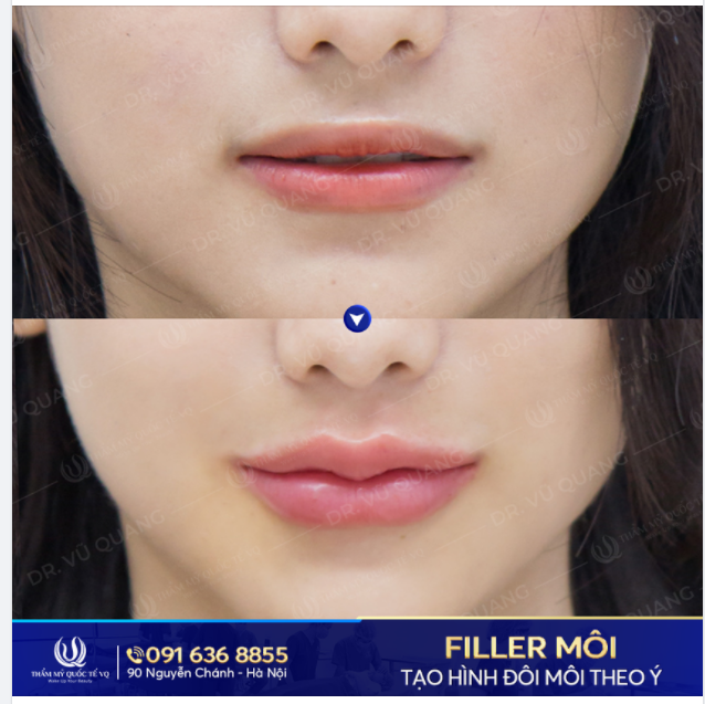 Môi đẹp người thương