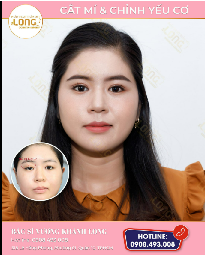 MỘT ĐÔI MẮT ĐẸP TẠO NÊN ĐIỀU GÌ
