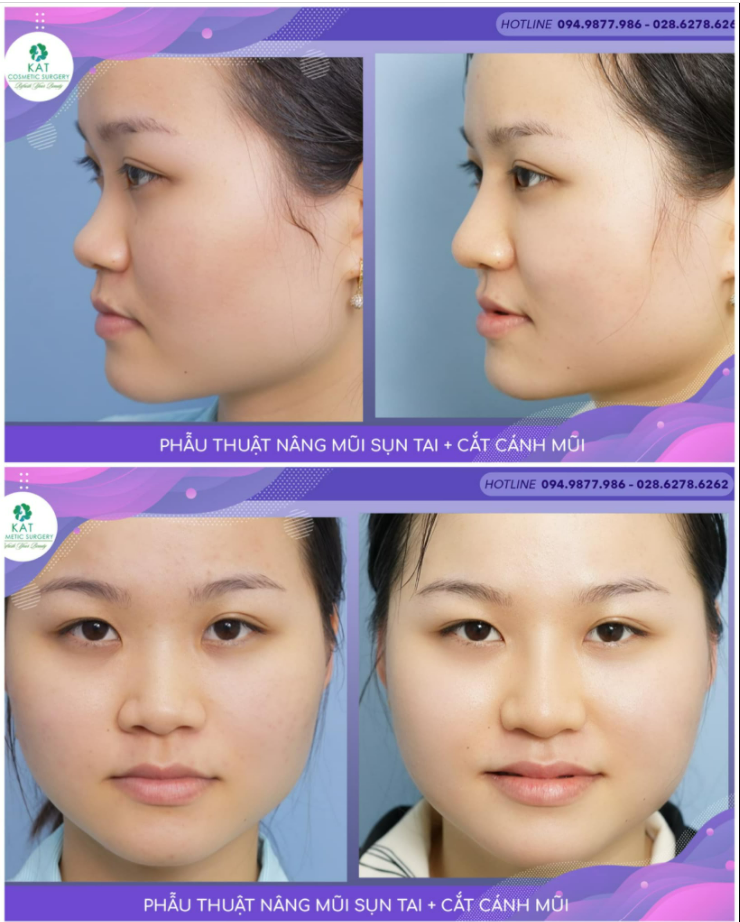 MỘT GÓC NGHIÊNG THẬT KHÁC