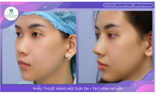 MỘT GÓC NGHIÊNG THẬT KHÁC