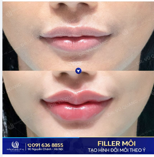 Một người con gái may mắn sở hữu môi cánh én không chỉ làm say mê nhiều chàng trai mà còn có đường sự nghiệp sáng lạng, vinh hoa phú quý