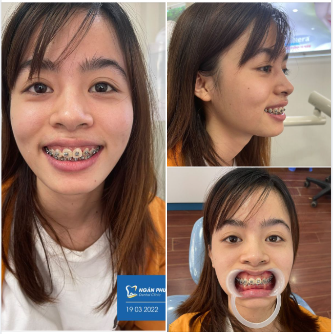 Một nụ cười bằng mười thang thuốc bổ