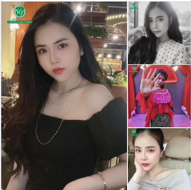 MŨI ĐẸP BẤT CHẤP THỜI GIAN
