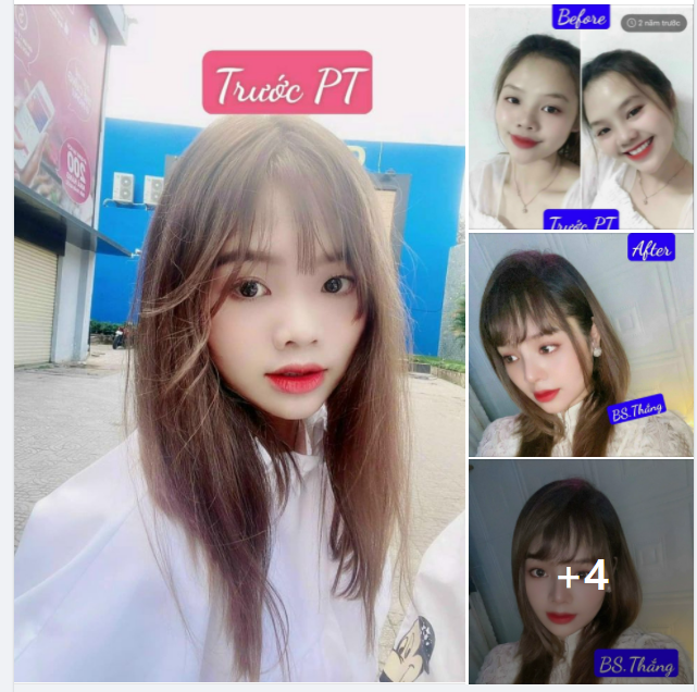 Mũi xinh dáng đẹp cao sang, an toàn tuyệt đối đến ngay Thảo Điền