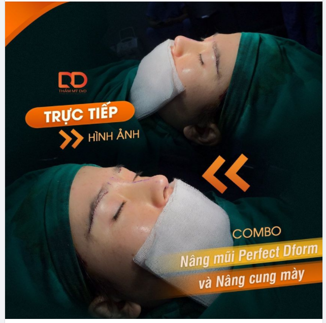 Muốn có MẮT ĐẸP, MŨI XINH chỉ là chuyện nhỏ với DrD