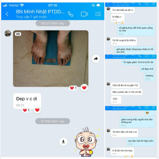 Nam bệnh nhân có chỉ số BMI 39,2 (124kg) giảm được 13,5kg sau 15 ngày thực hiện Thu nhỏ Dạ dày giảm béo