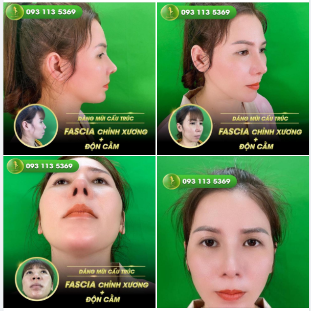 Nâng cấp nhan sắc là nâng cấp cuộc đời