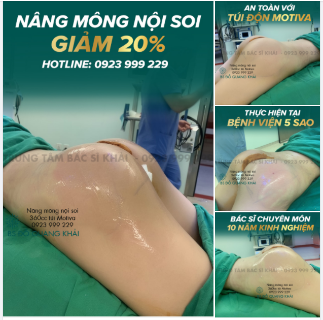 NÂNG MÔNG NỘI SOI GIẢM 20% CHO TẤT CẢ KHÁCH HÀNG