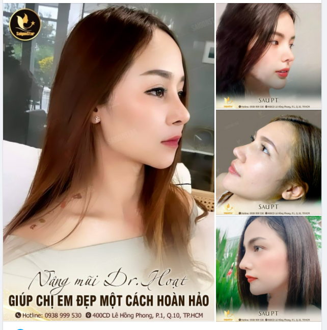 NÂNG MŨI BS.HOẠT GIÚP CHỊ EM ĐẸP MỘT CÁCH HOÀN HẢO