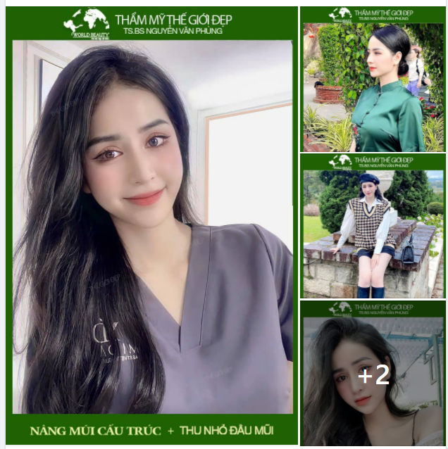 Nâng mũi cấu trúc kết hợp Thu nhỏ đầu mũi