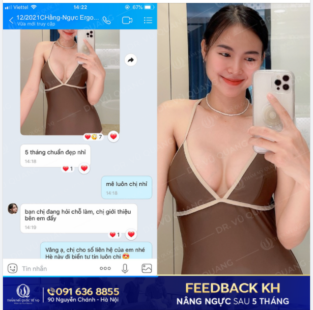 Nâng ngực đẹp xinh - Diện đồ lung linh
