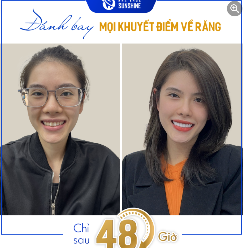 NÂNG TẦM NHAN SẮC CHỈ VỚI 48H