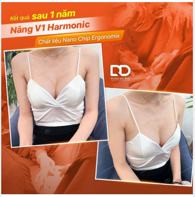 Nâng V1 được 1 năm, tại sao nên thường xuyên tái khám Quá trình tái khám tại DrD sẽ được thực hiện những gì