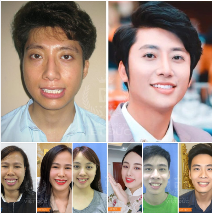 NGÀY ẤY - BÂY GIỜ