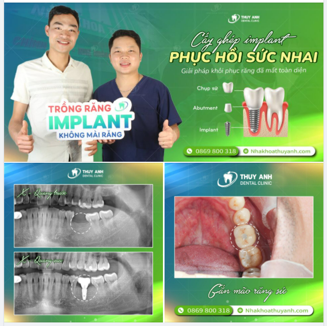 NGHỊCH LÝ TRONG CHĂM SÓC RĂNG MIỆNG