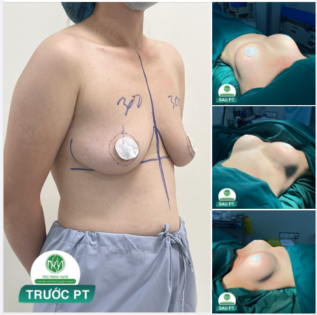 NGỰC ĐẸP CHO NGÀY CUỐI CÙNG CỦA THÁNG 3