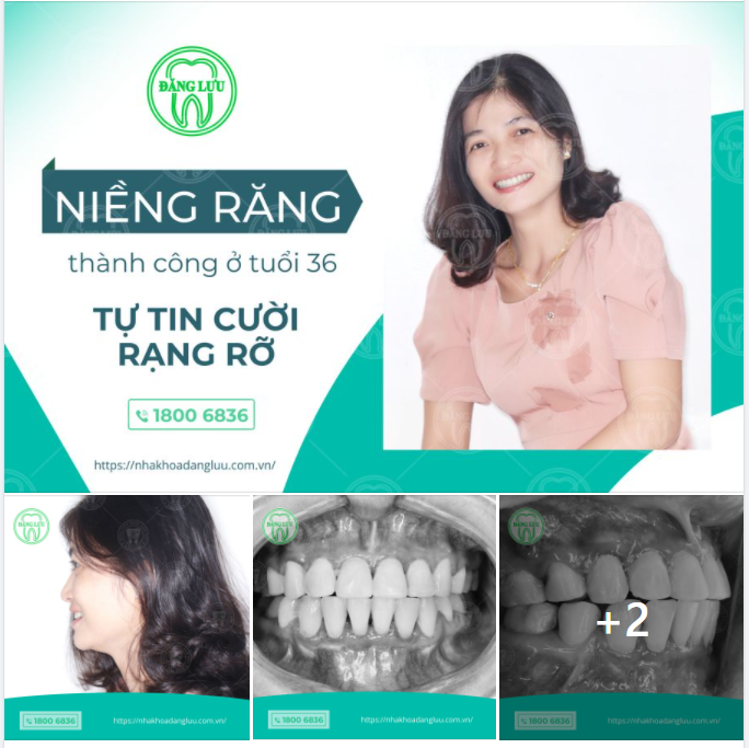 Người ta nói, nụ cười rạng rỡ chính là một trong những vũ khí sắc bén để tạo nên dấu ấn tốt đẹp trước mặt người đối diện