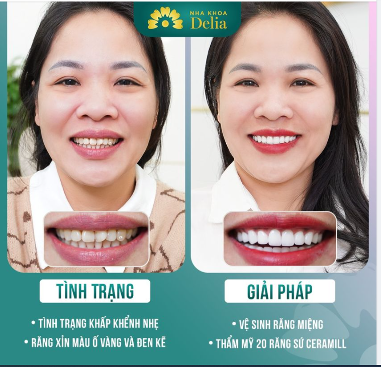 Nha Khoa Delia - Kiến Tạo Nụ Cười Rạng Rỡ Mỗi Ngày