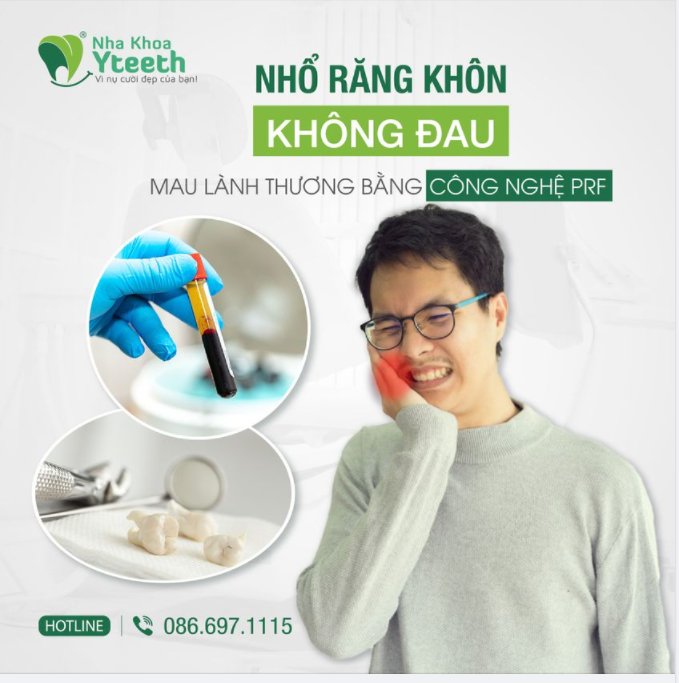 Nhổ răng khôn bằng phương pháp PRF là phương pháp lấy máu tự thân sau đó được tách chiết bằng máy móc công nghệ cao để lấy tiểu cầu trong máu.