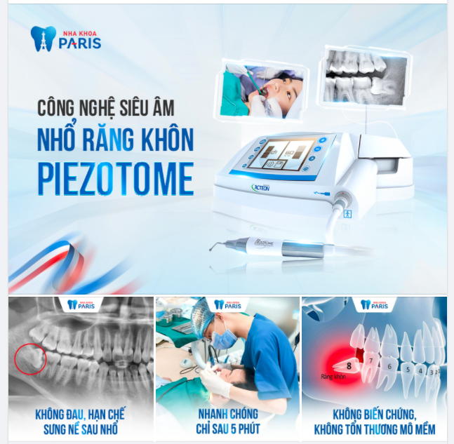 NHỔ RĂNG KHÔN ĐỒNG GIÁ 999K BẰNG MÁY