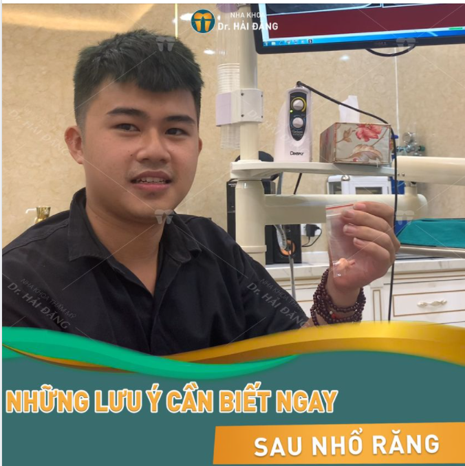 Những lưu ý cần biết ngay sau khi nhổ răng
