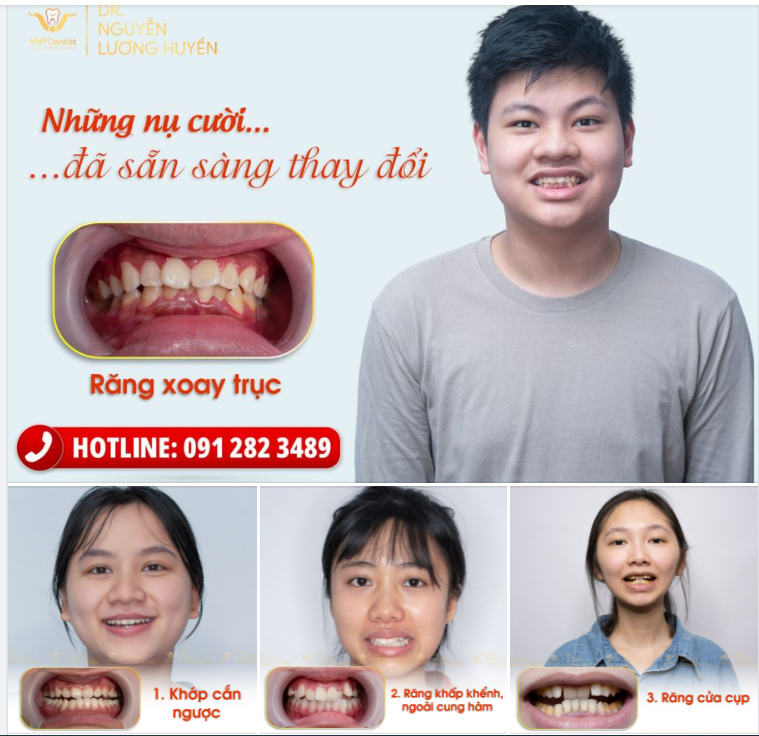 NHỮNG NỤ CƯỜI ĐÃ SẴN SÀNG THAY ĐỔI