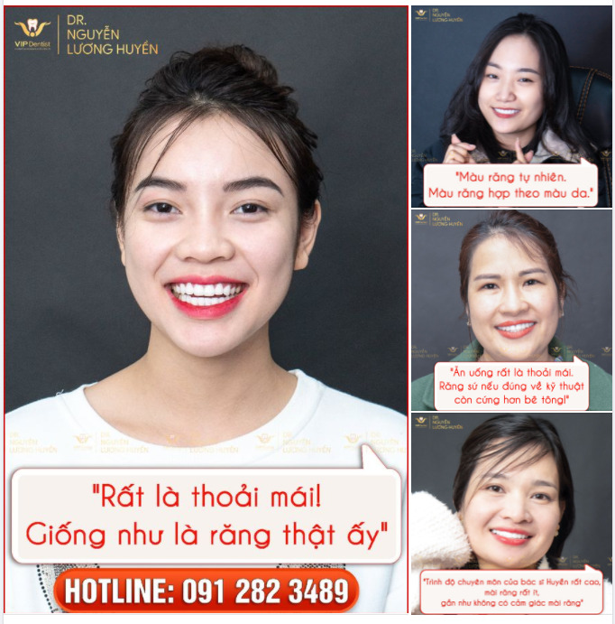 NHỮNG NỤ CƯỜI MỚI NÓI GÌ VỀ RĂNG SỨ VIP DENTIST?