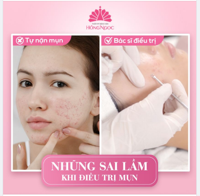 NHỮNG SAI LẦM KHI ĐIỀU TRỊ MỤN KHÔNG PHẢI AI CŨNG BIẾT