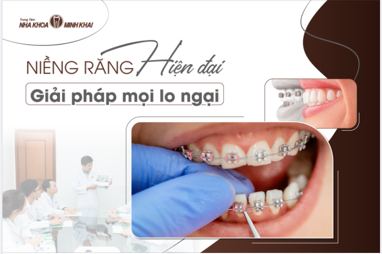NIỀNG RĂNG HIỆN ĐẠI, GIẢI QUYẾT MỌI LO NGẠI