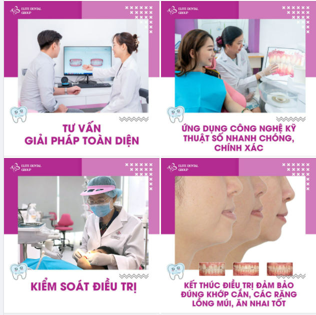 NIỀNG RĂNG INVISALIGN CHUYÊN SÂU TẠI ELITE DENTAL