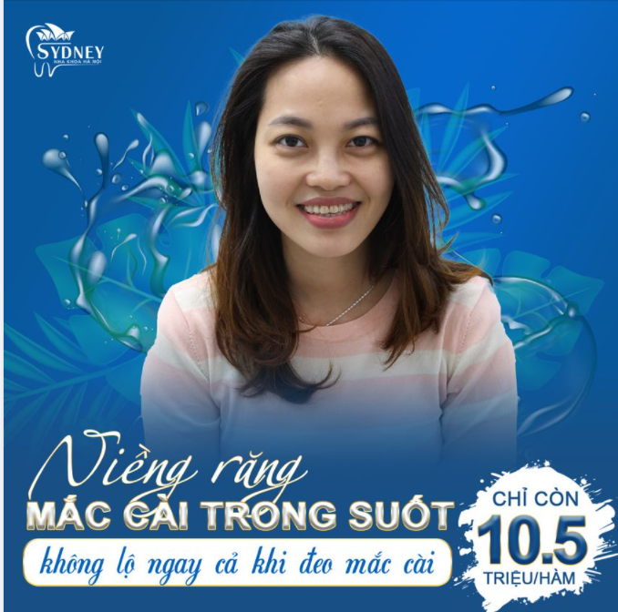 NIỀNG RĂNG MẮC CÀI PHA LÊ - TỰ TIN KHOE NỤ CƯỜI TỎA SÁNG