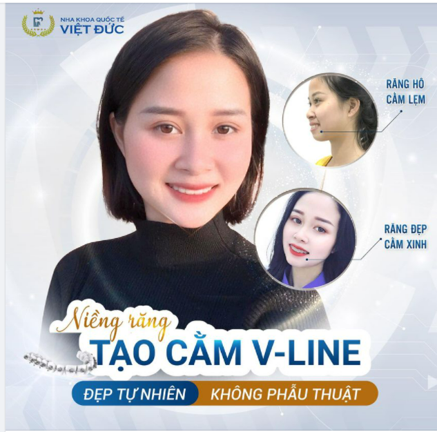 NIỀNG RĂNG RỒI MỚI THẤY HỐI HẬN....VÌ KHÔNG NIỀNG RĂNG SỚM HƠN NIỀNG 1 MÀ ĐƯỢC 2
