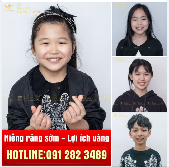 NIỀNG RĂNG SỚM - LỢI ÍCH VÀNG