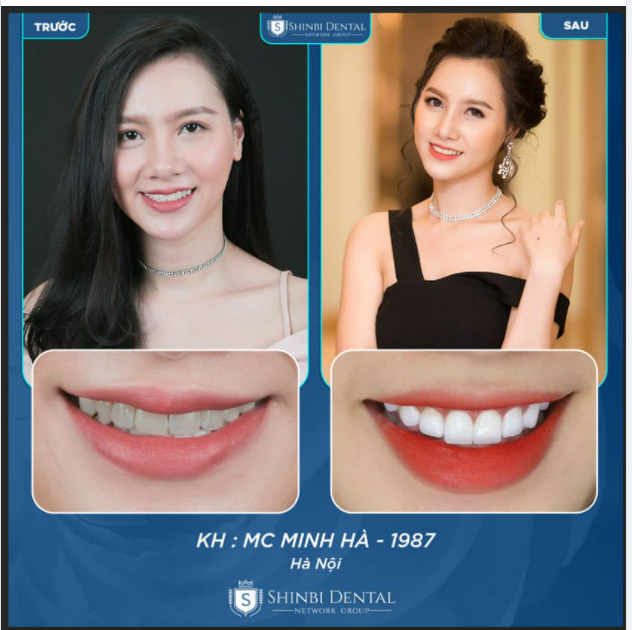 NỤ CƯỜI BỪNG SÁNG THÁNG 4 ĐẦU HẠ