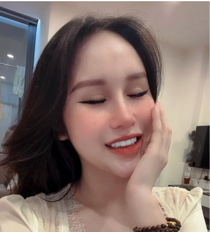 Nụ cười chị Ngọc Ánh (khách hàng thẩm mỹ răng sứ)
