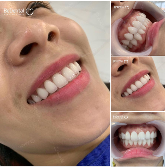 Nụ cười đẹp tự nhiên nhưng không phải tự nhiên mà đẹp