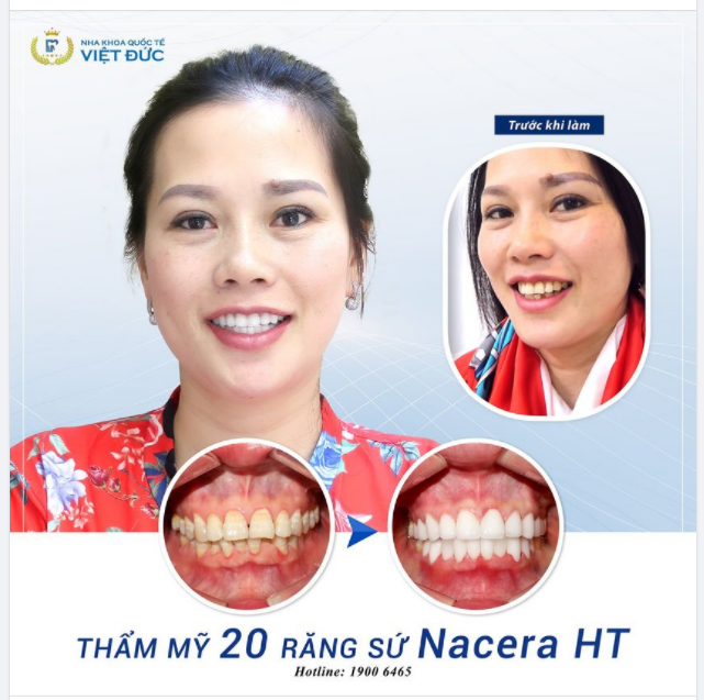 NỤ CƯỜI - TRANG SỨC ĐẸP NHẤT CỦA NGƯỜI PHỤ NỮ
