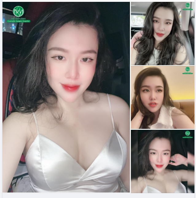 Ở ĐÂY CÓ MỘT ĐÔI MẮT ĐẸP RẠNG NGỜI
