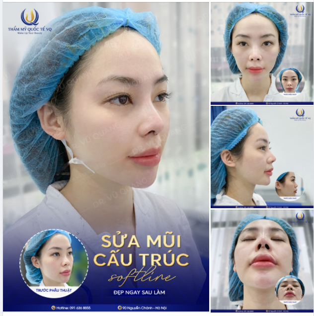 Ôi em cứ ngắm mãi không chán ý. Em ưng quá​​​​​​​ - Minh Thu rất hài lòng với dáng mũi mới ngay sau pt