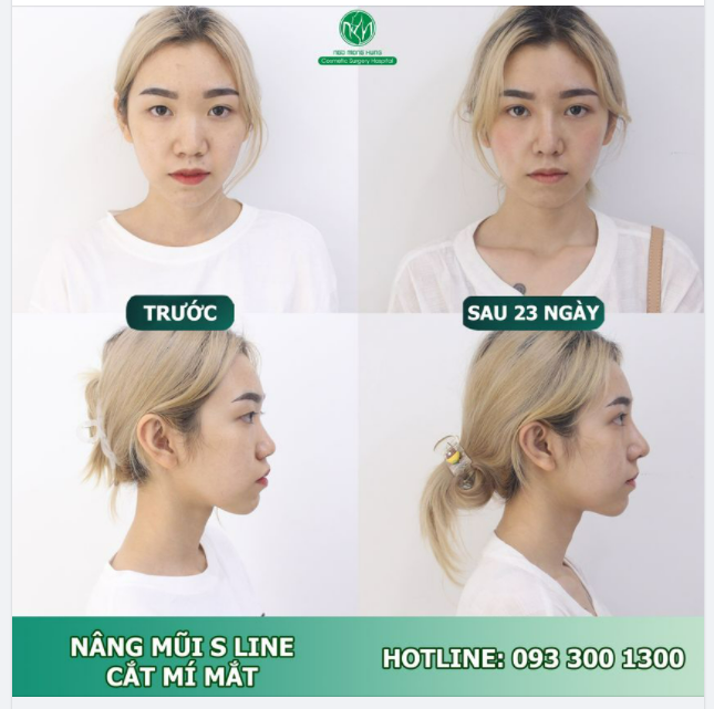 PHIÊN BẢN HOÀN HẢO HƠN CỦA KH SAU 23 NGÀY