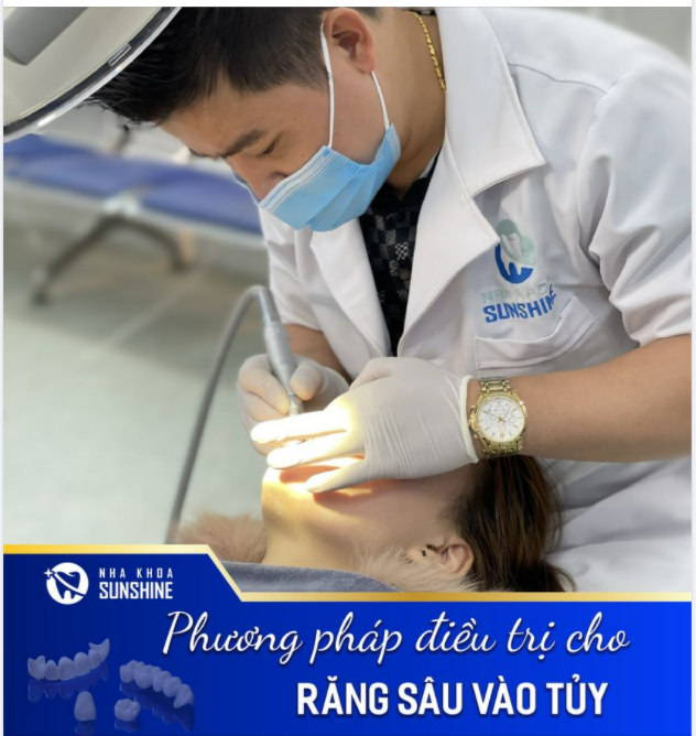 PHƯƠNG PHÁP ĐIỀU TRỊ CHO RĂNG SÂU VÀO TUỶ HIỆU QUẢ